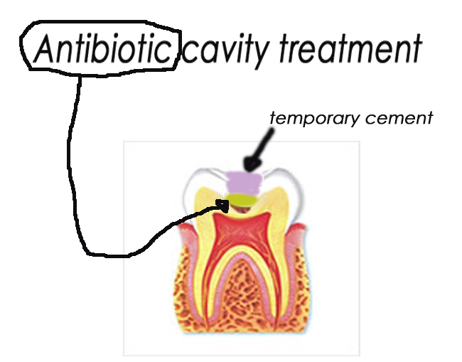 antibiotic teratment