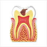 cavity